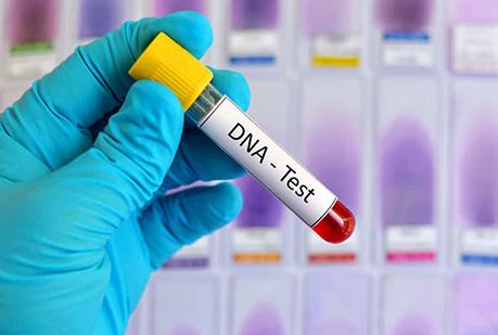 تحليل الـDNA